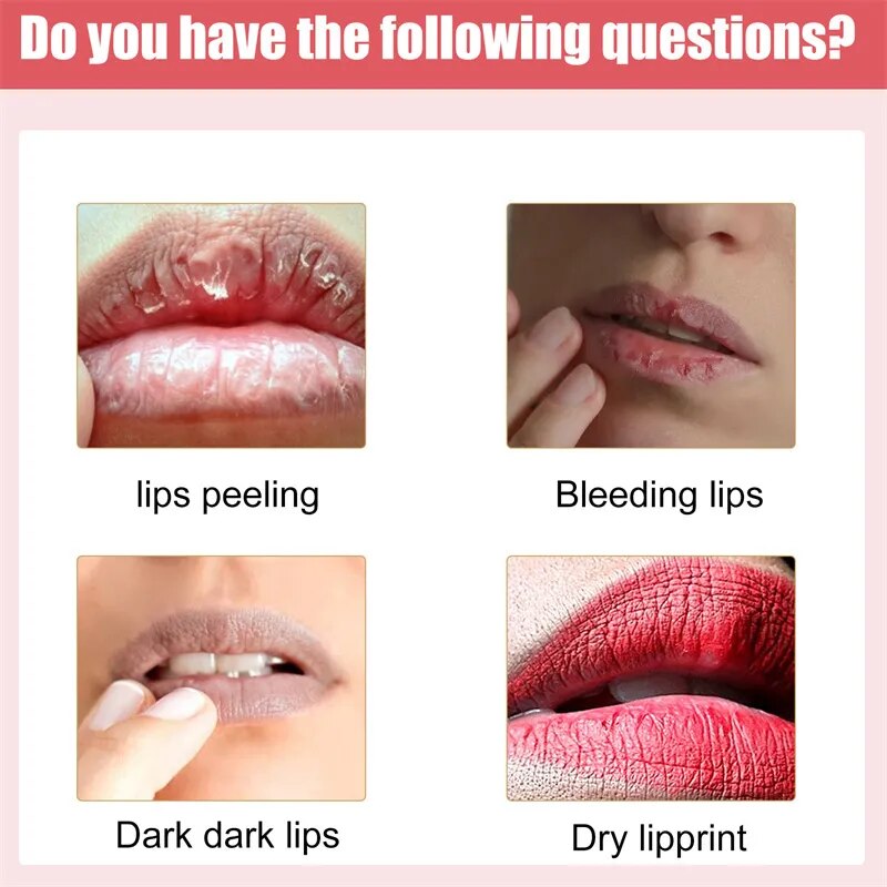 Lips Pink Cream Fresh Bleaching Treatment Remove Dark Smoke Lips Lip Balm Whitening Moisturizer Nourish Essence Dilute Melanin