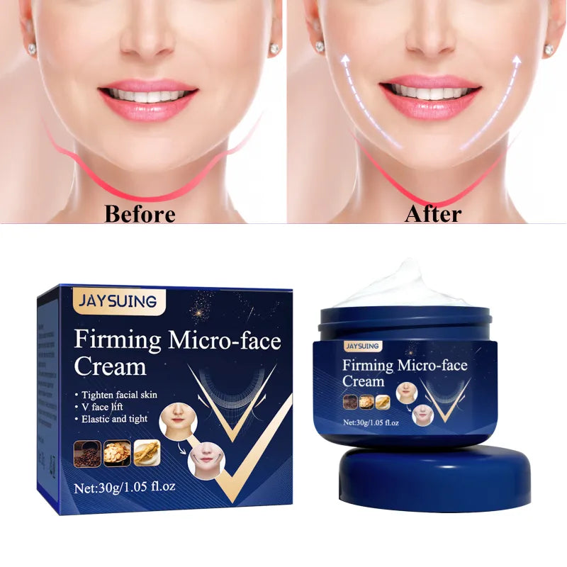 V-Shape Slimming Cream Firming Face-lift Slimming Removal  Double Chin Masseter Muscle Face Fat Burning Anti-aging Products